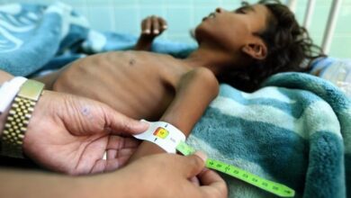 صورة منظمة دولية: اليمن يعاني من ثاني أكبر أزمة غذائية عالمية