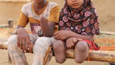 صورة بينهم نساء وأطفال.. مقتل وإصابة 363 مدنيا بألغام الحوثي منذ 2021