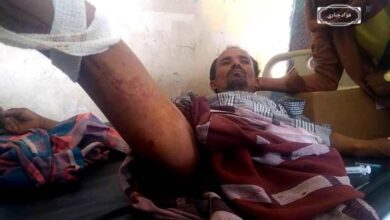صورة إصابة مواطن برصاص قناص حوثي شمال الضالع