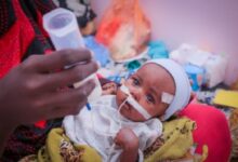 صورة “الصحة العالمية” تعلن علاج 2255 طفلًا مصابًا بسوء التغذية في اليمن