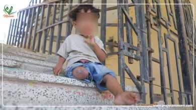 صورة إصابة طفلة بانفجار لغم حوثي جنوبي الحديدة اليمنية